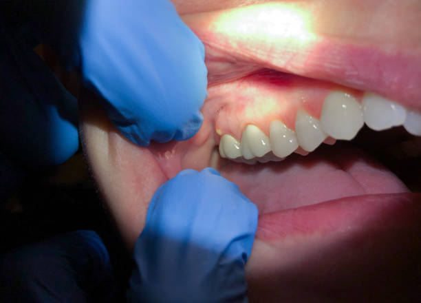 Best Emergency Dental Surgery in Mitchell, SD