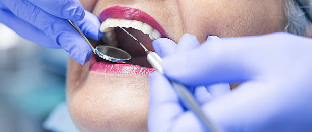Best Emergency Wisdom Teeth Removal in Mitchell, SD